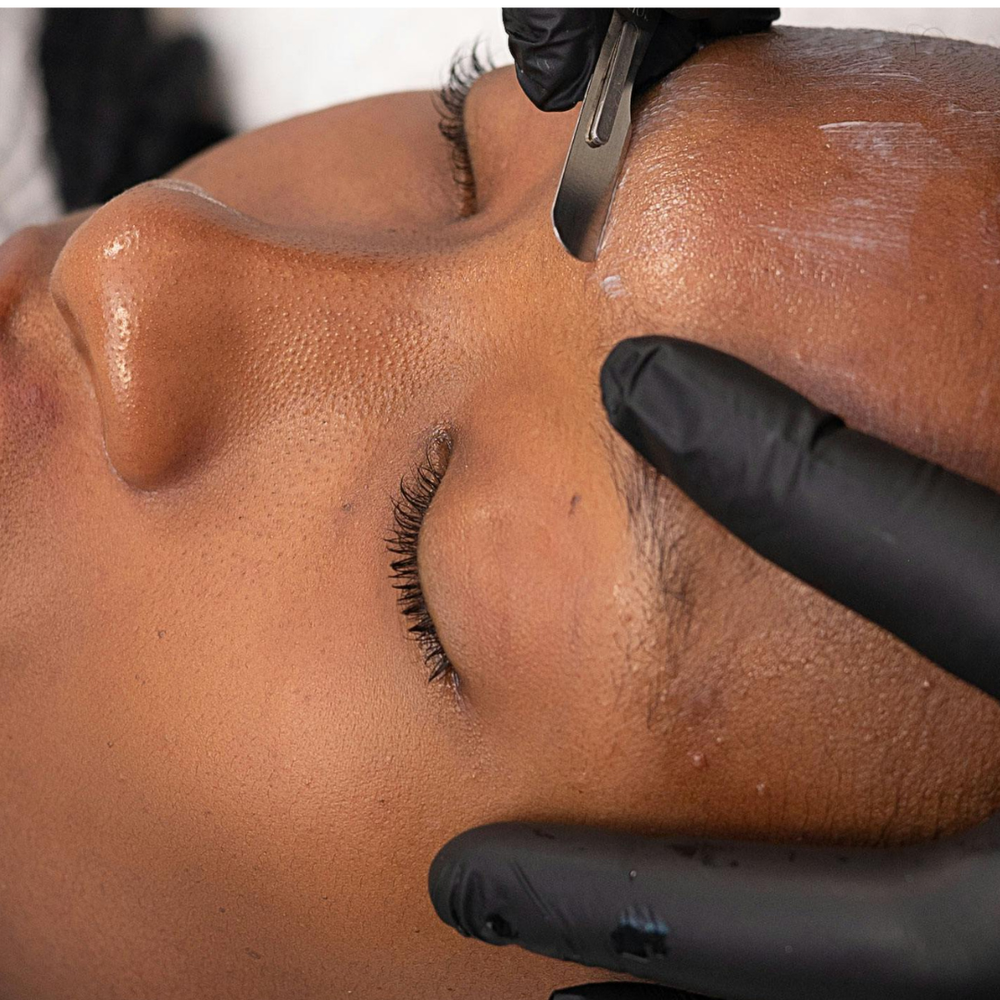 Dermaplaning Facial