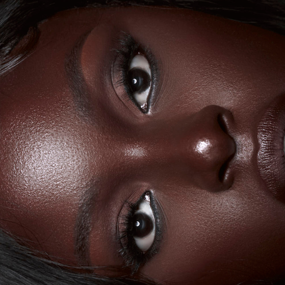 Hyperpigmentation Support