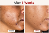 The Dark Spot Brightening Serum