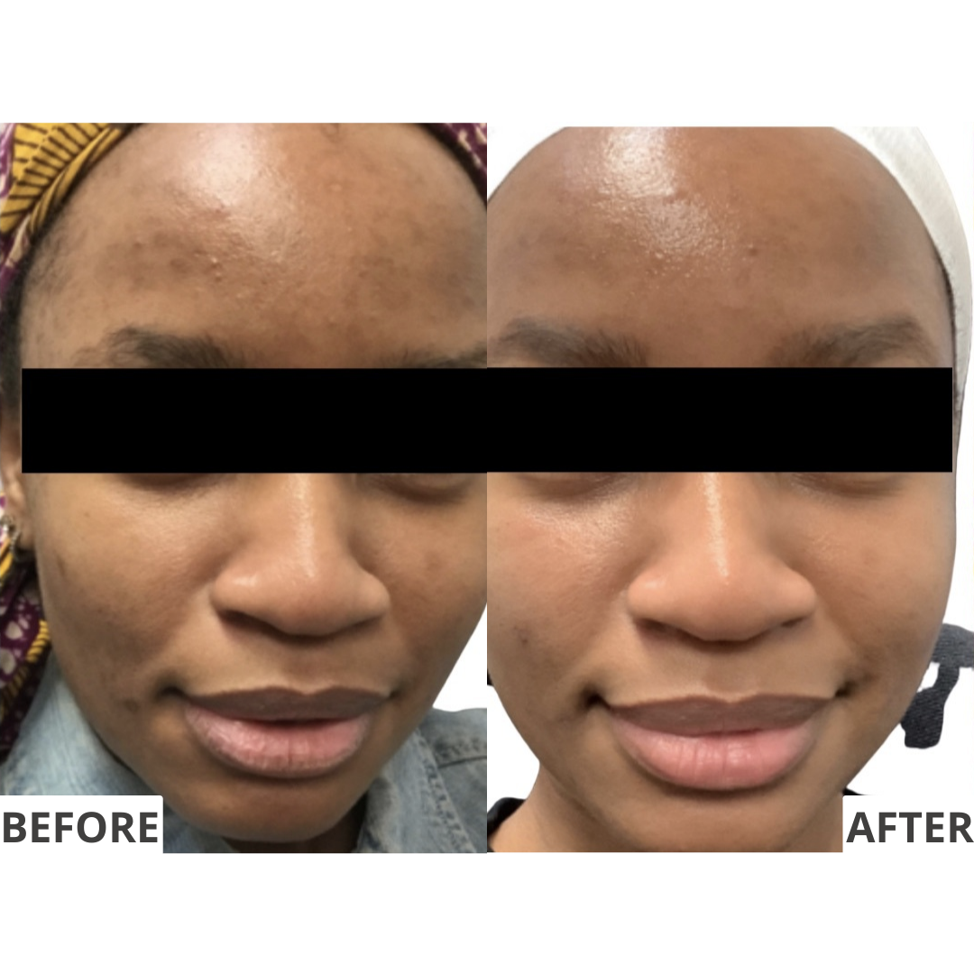 The Advanced Brightening System