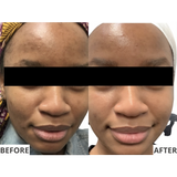 The Advanced Brightening System