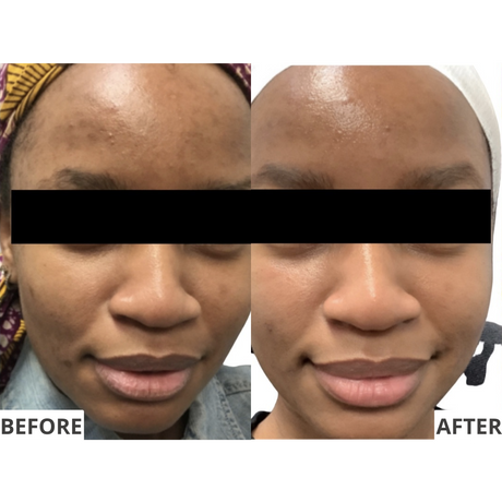 The Advanced Brightening System