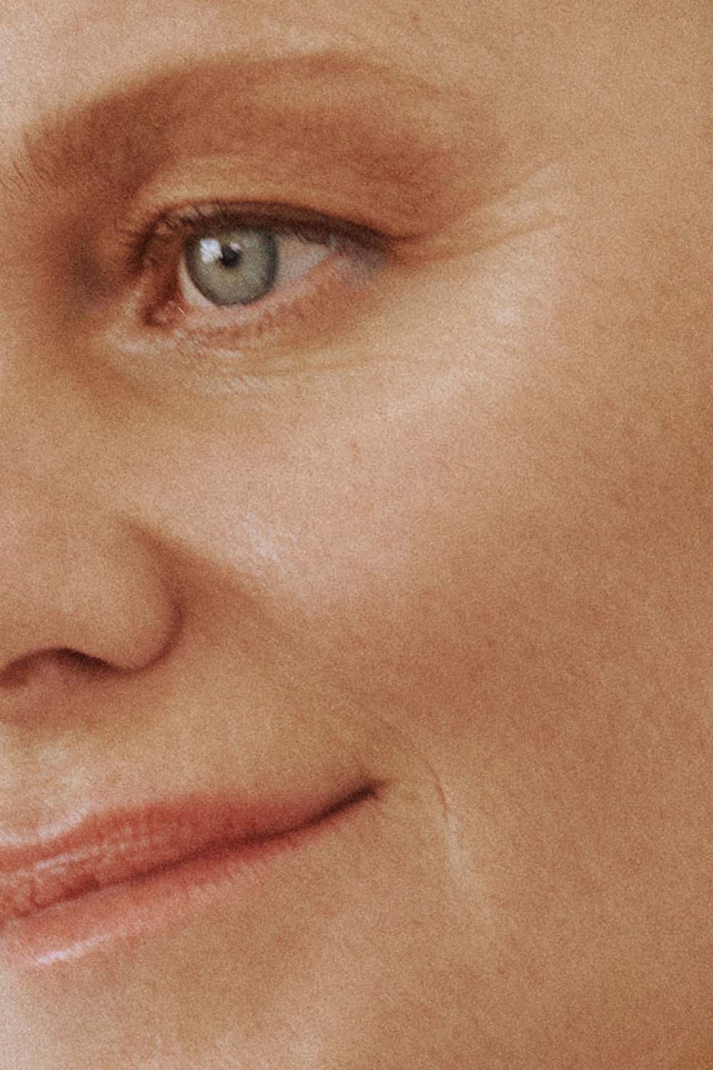 Microneedling