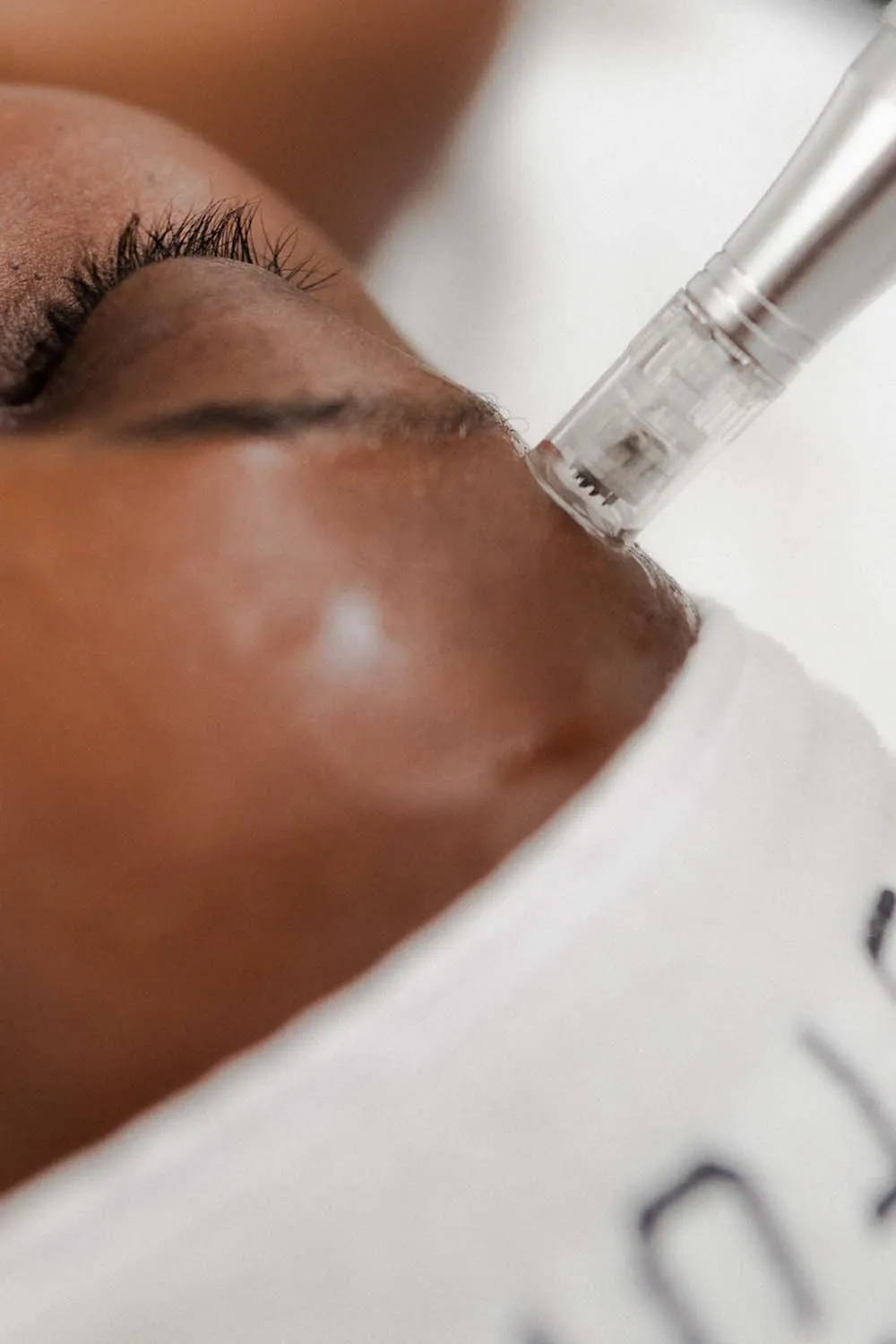 Hyperpigmentation Support