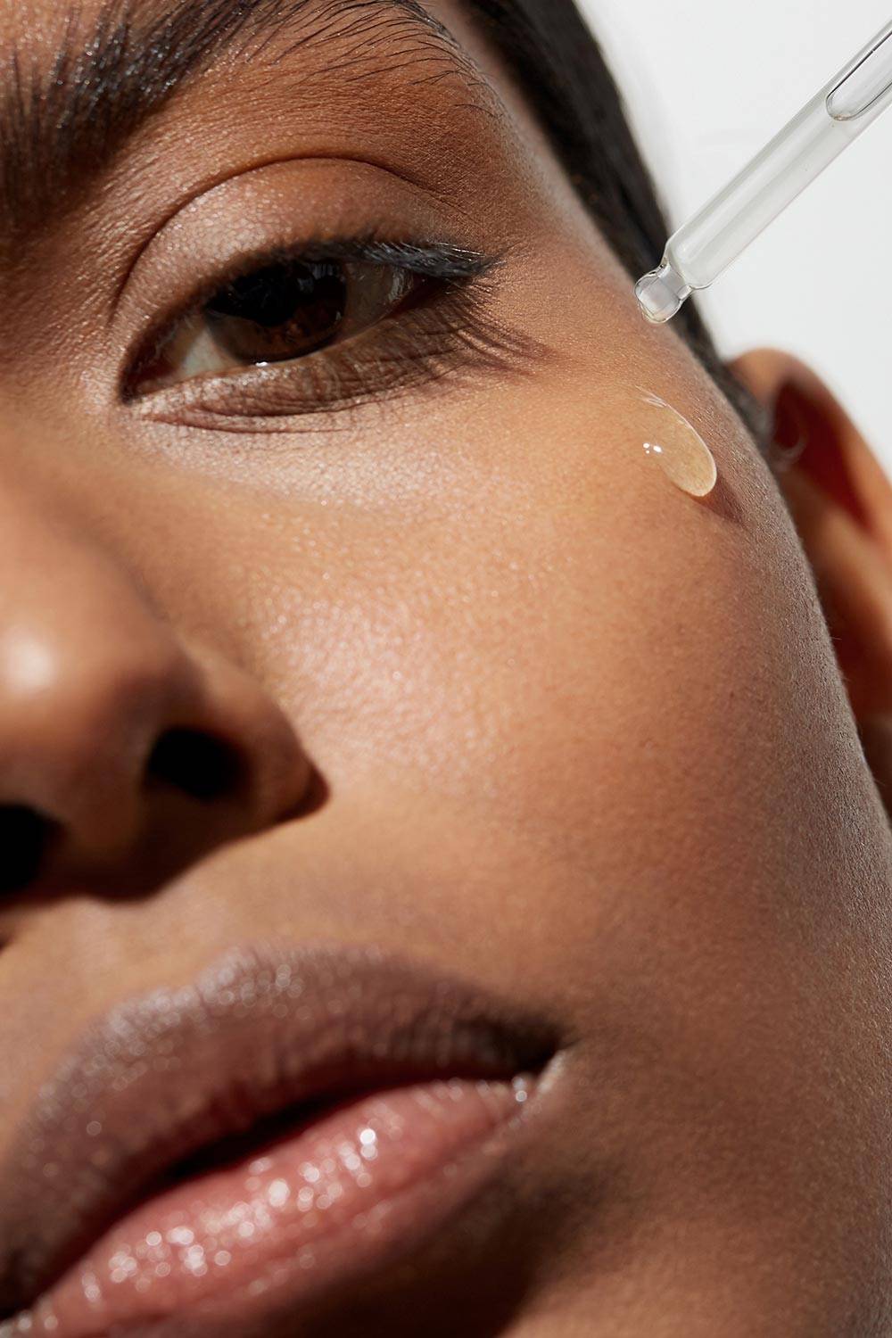 chemical peel