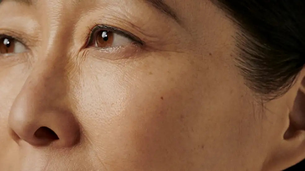 skin consultation
