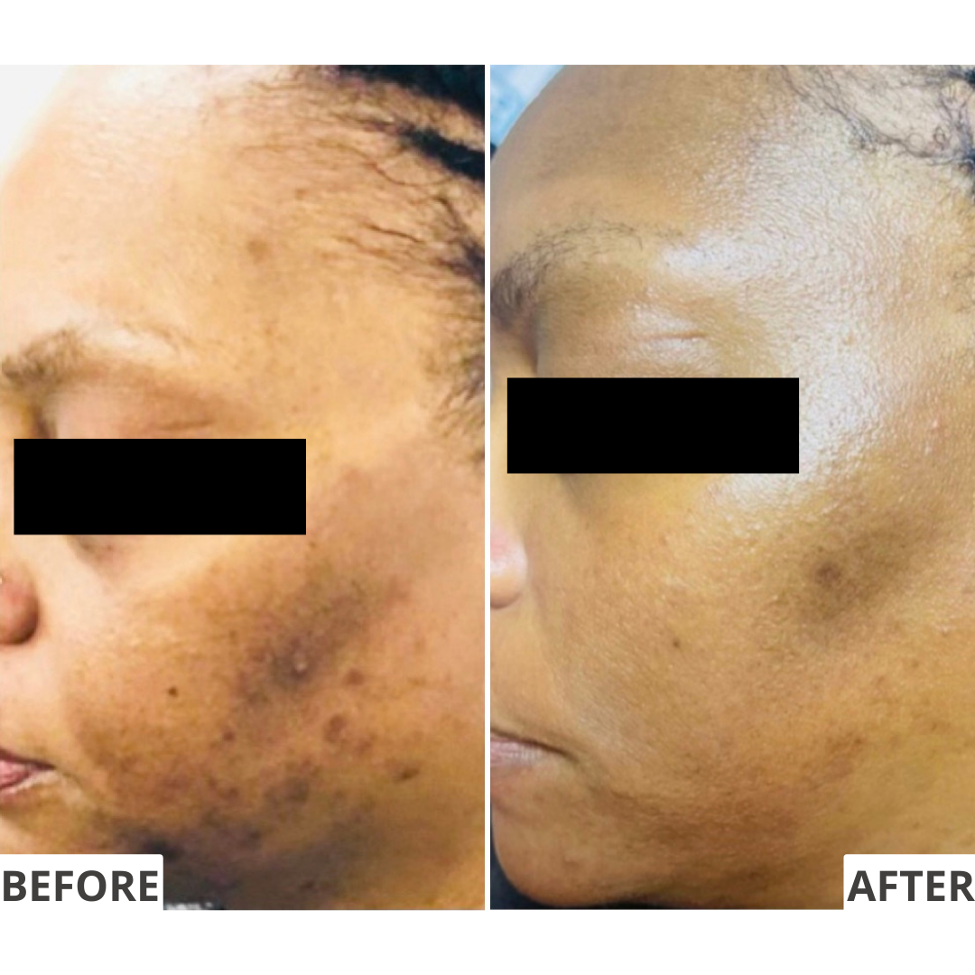The Resurfacer Active Retinol 3%