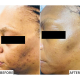 The Resurfacer Active Retinol 3%
