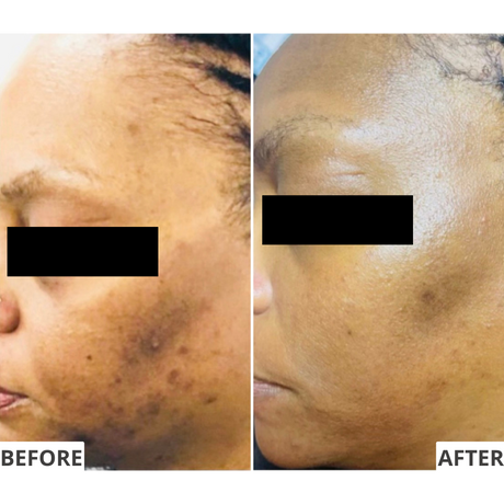 The Resurfacer Active Retinol 3%