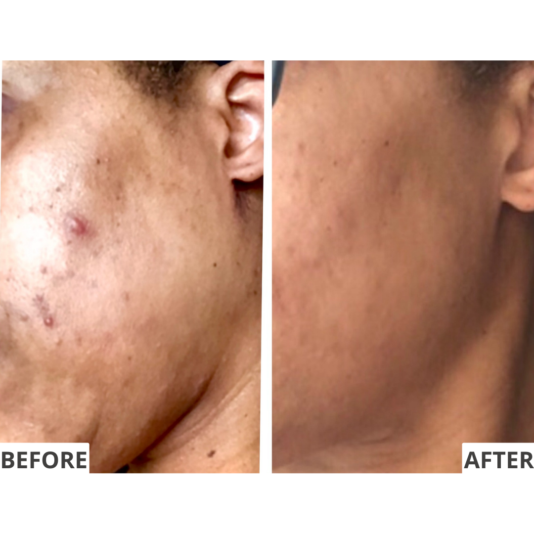 The Illuminator Clear Complexion Pads