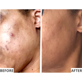 The Illuminator Clear Complexion Pads
