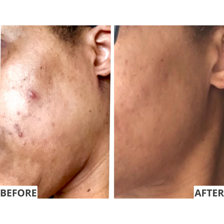 The Illuminator Clear Complexion Pads