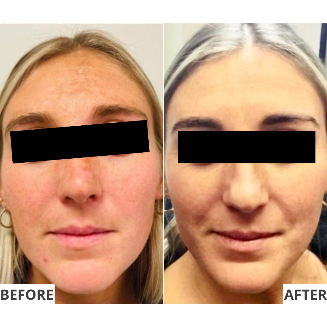 The Antiox Hydraserum: 25% Vitamin C Complex, Vit E & Ferulic Acid