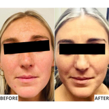 The Antiox Hydraserum: 25% Vitamin C Complex, Vit E & Ferulic Acid